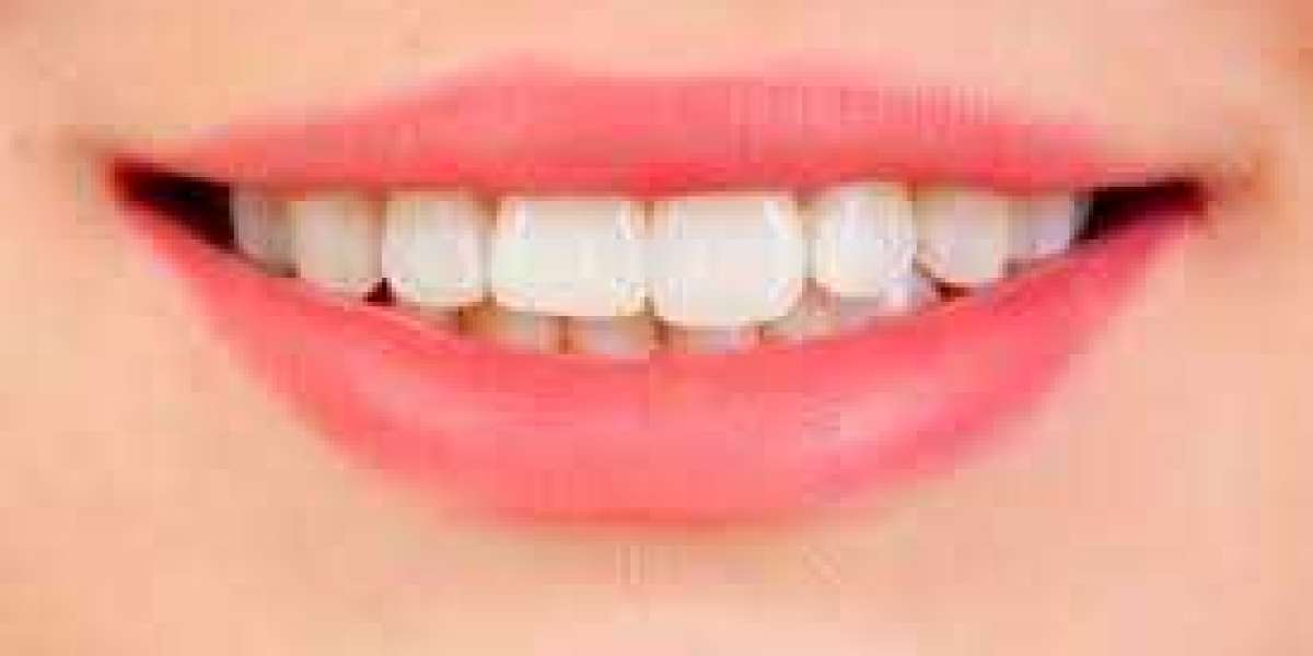 Renew Dental Best Formula For Strong Teeth Price In 2022?