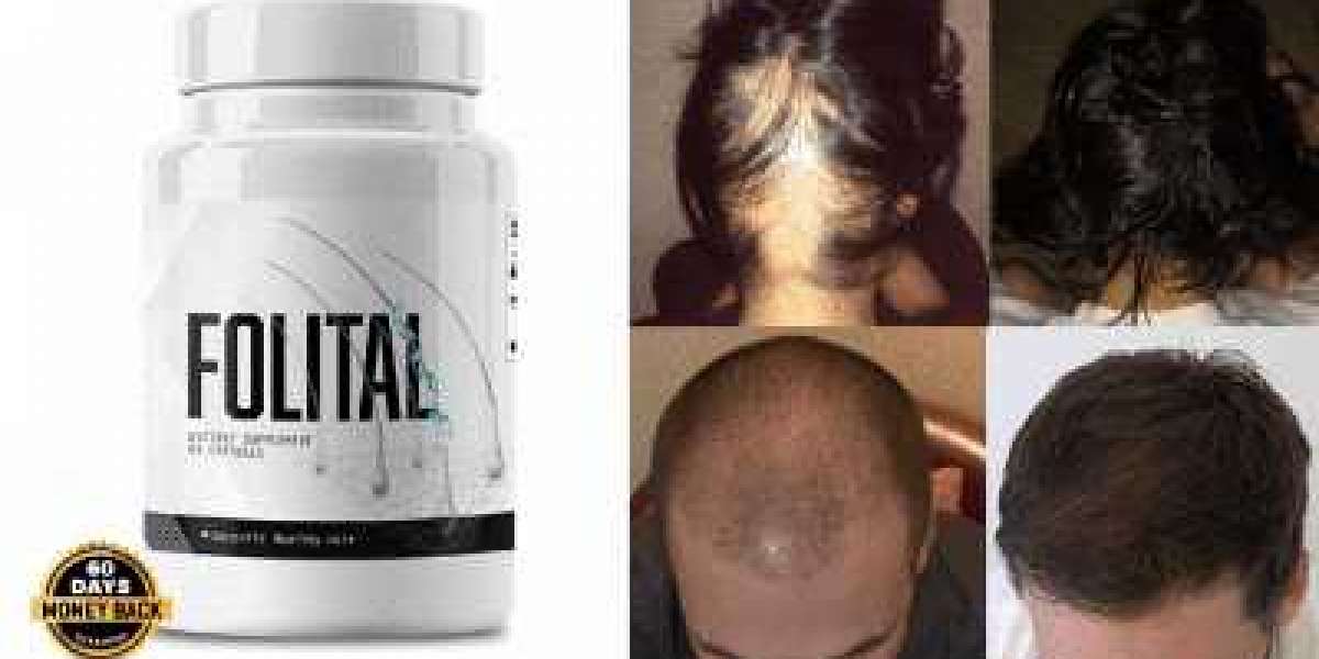 Folital Reviews - Is Folital Supplement Good For Hair Loss? Read To Know