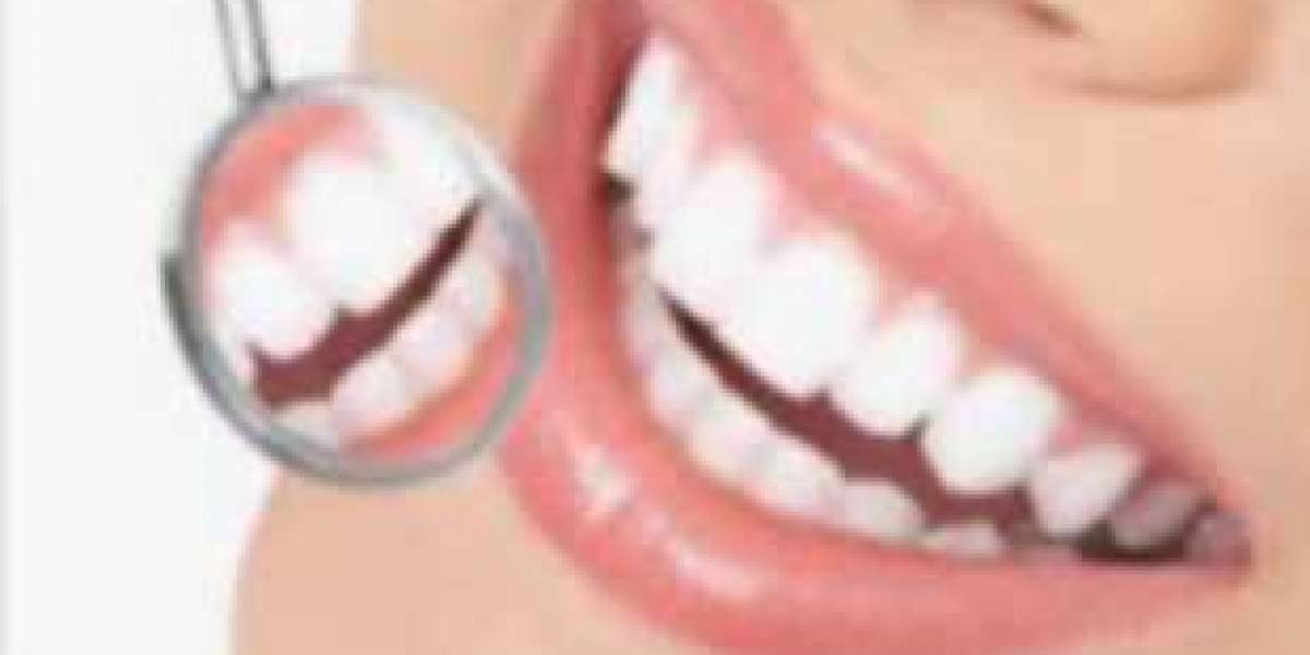 G-Force Dental Supplement Reviews: SHOCKING Customer Report!