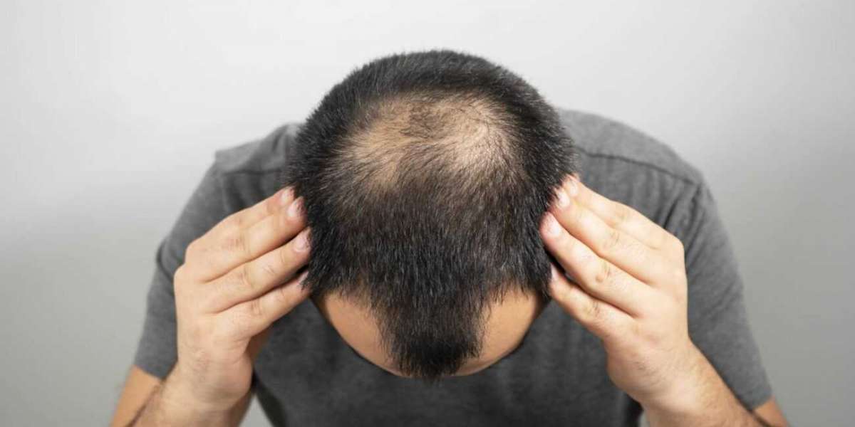 Revifol Reviews – Legit Hair Growth Ingredients That Work?