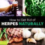 How To Get Rid Of Herpes Outbreak