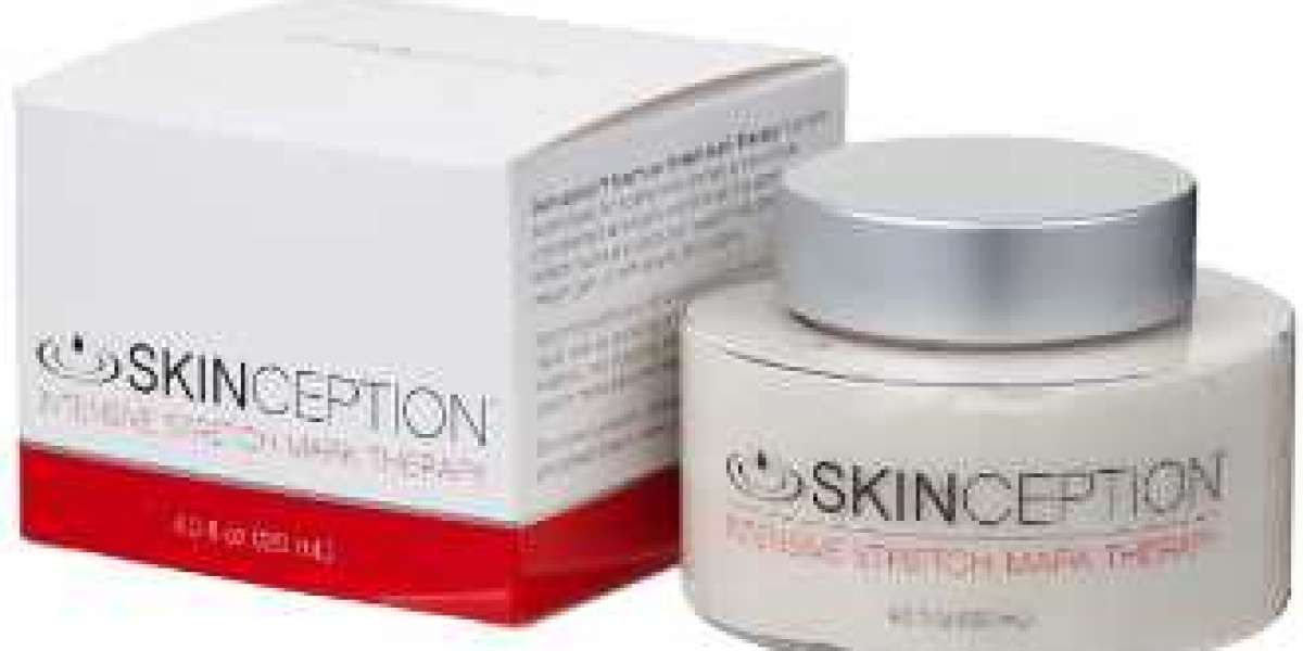 SKINCEPTION REVIEWS: IS THIS INTENSIVE STRETCH MARK THERAPY CREAM EFFECTIVE? READ SHOCKING USER REPORT