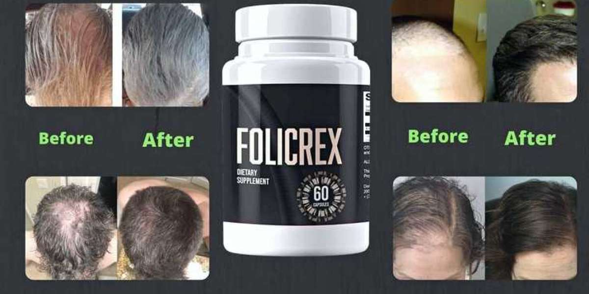Folicrex [USA]: Clinically Proven Formula & Easy To Use!