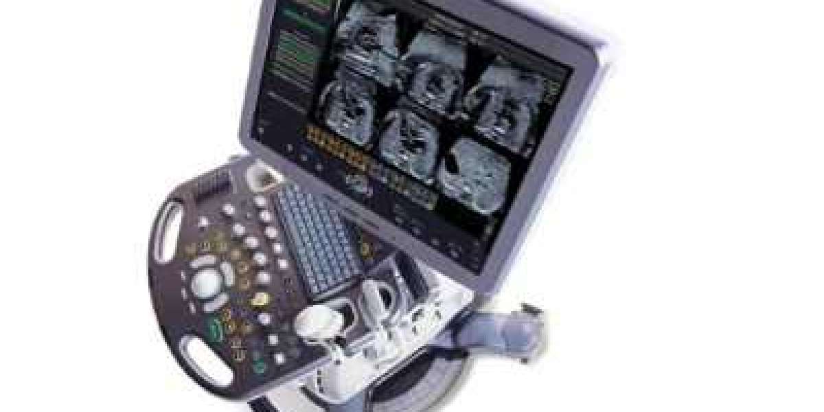 Ultrasound Market: Global Industry Analysis, Size, Share, Growth, Trends, and Forecasts 2023-2030
