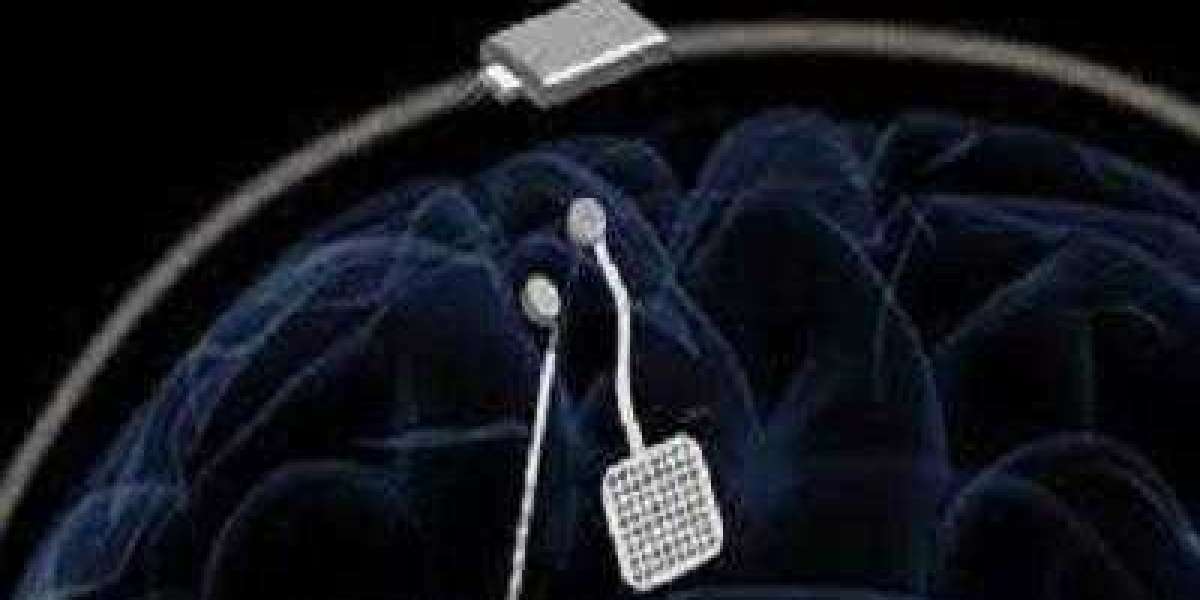 Brain Pacemaker Market: Global Industry Analysis, Size, Share, Growth, Trends, and Forecasts 2023-2030