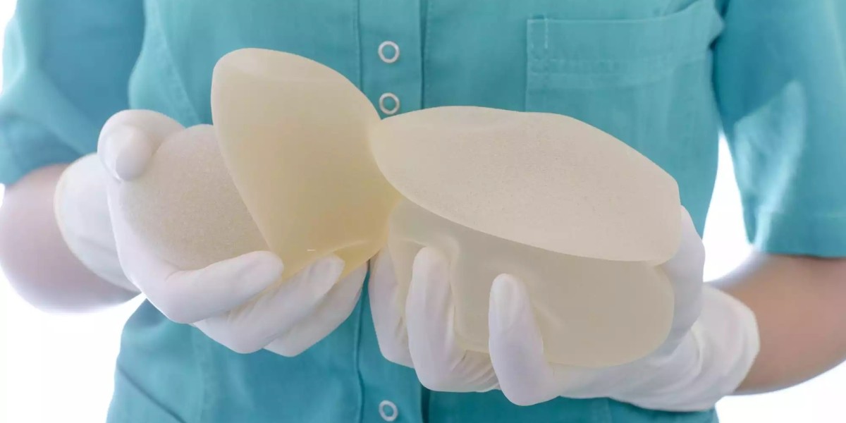 Breast Implants Market Share of Top Key Players with Tactics for Industry Growth