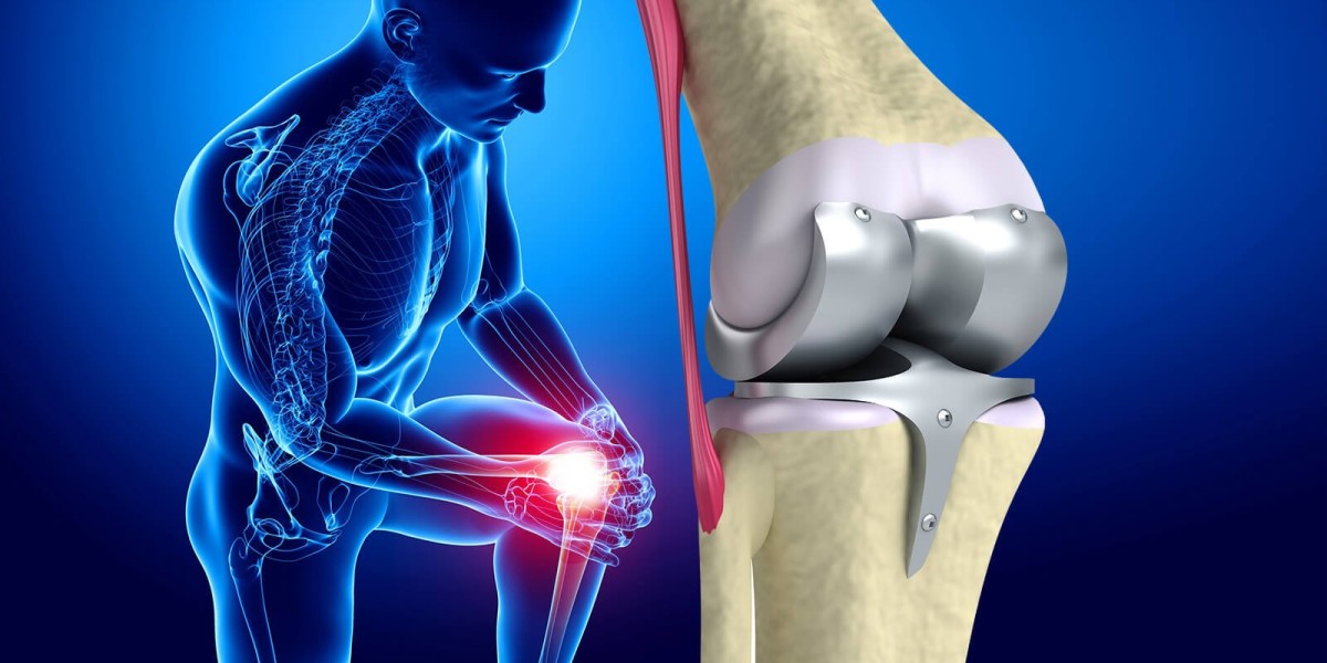 Global Knee Replacement Market Share to Produce a High Profit