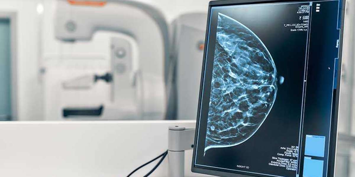 Mammography System Market Statistics, Business Opportunities, Competitive Landscape and Industry Analysis Report