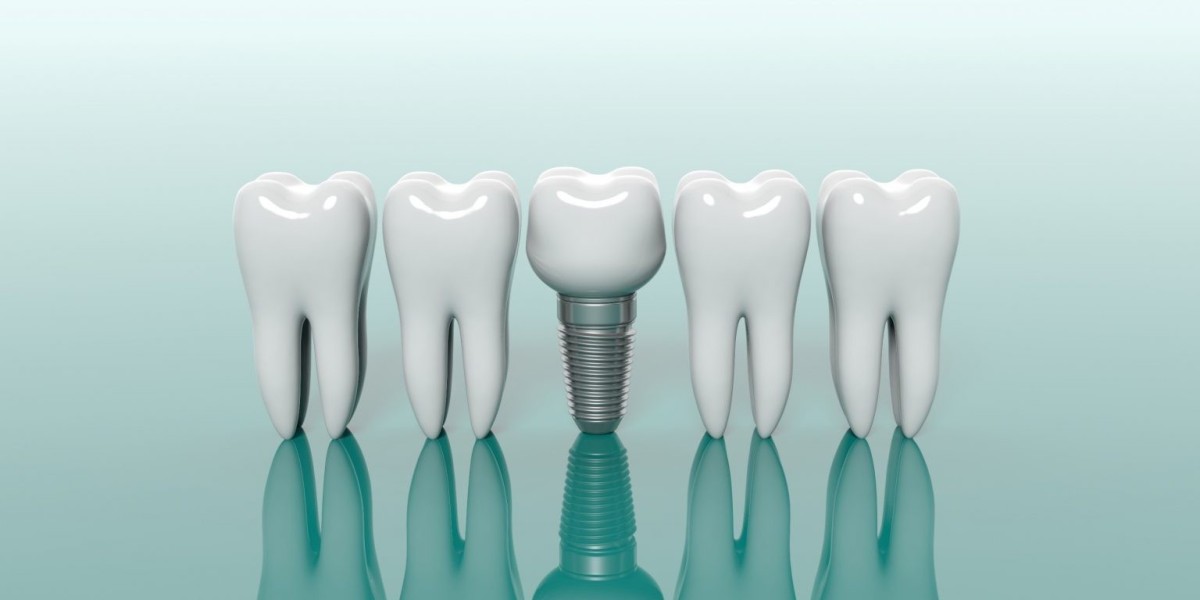 The Dental Restorative and Regenerative Material Market Outlook Shows Industry Will Be Driven by Research Lab Expansion