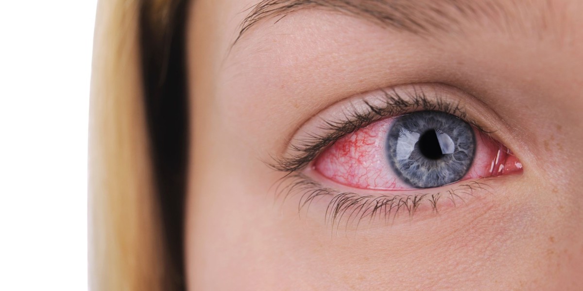 Fungal Eye Infection Market Outlook Report on Key Drivers Boosting Industry Growth