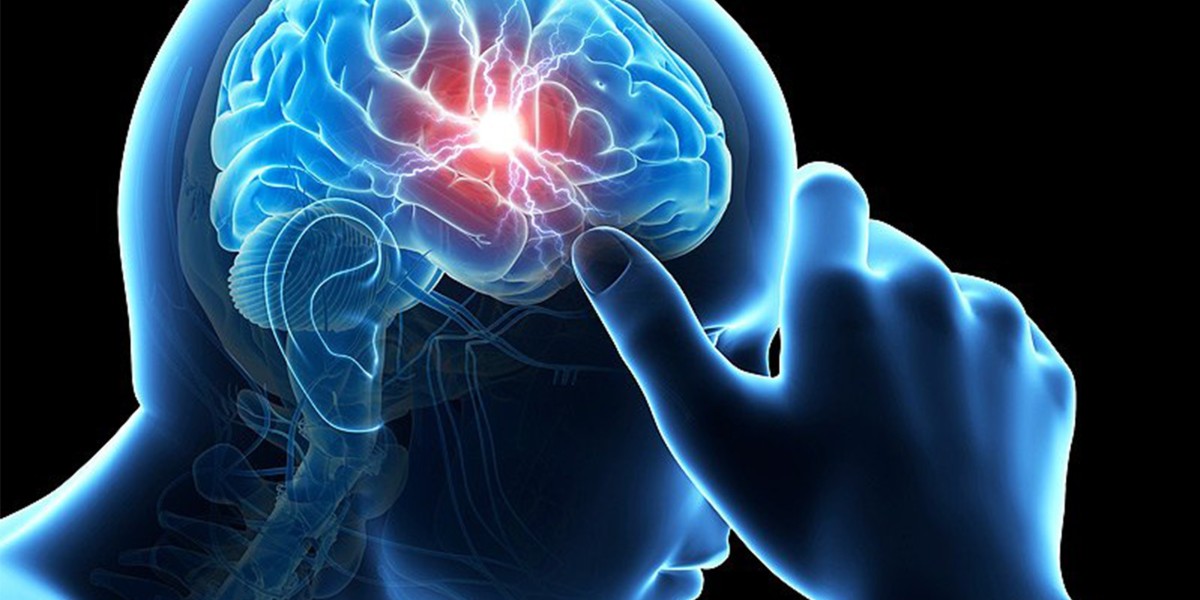 Global Head Trauma Market Outlook 2022-2030, Insights in the Industry Size, Share & Growth