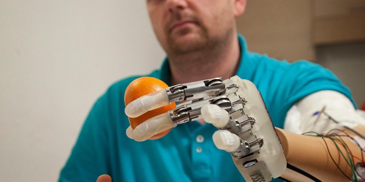 The industry is to Perceive a Thriving Growth; MRFR Unleashes Neuroprosthetics Market Outlook