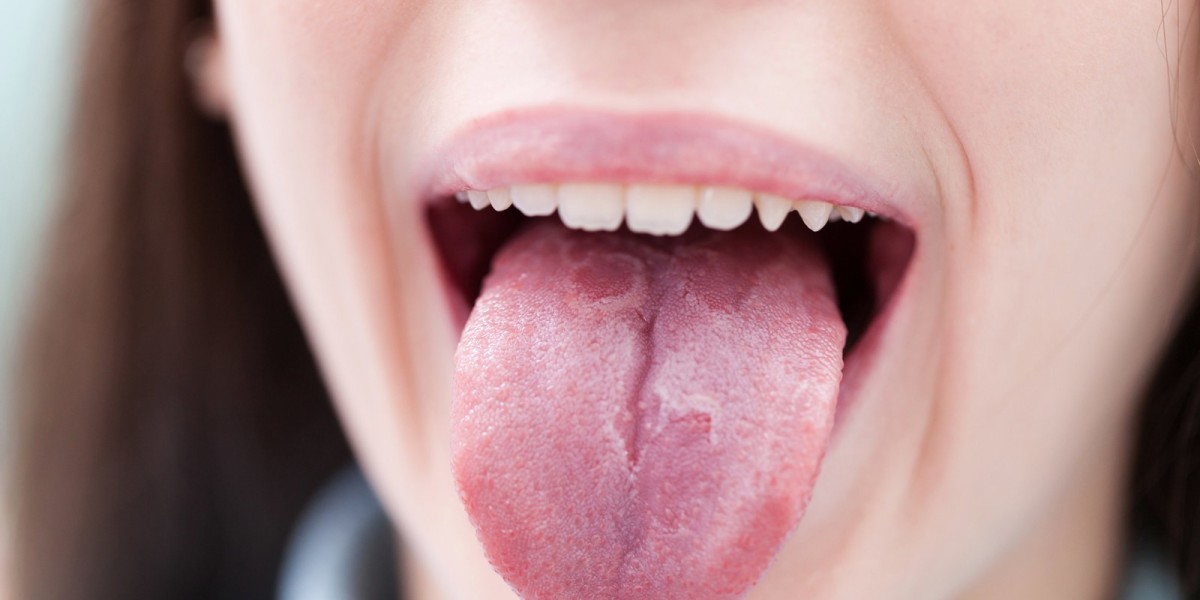 Geographic Tongue Market Outlook, Dynamics & Insights 2022-2030