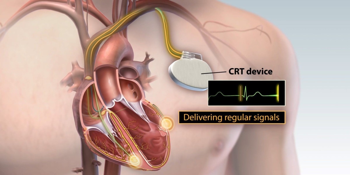Cardiac Resynchronization Therapy (CRT) Market Outlook on Industry Players Focusing On New Product Development