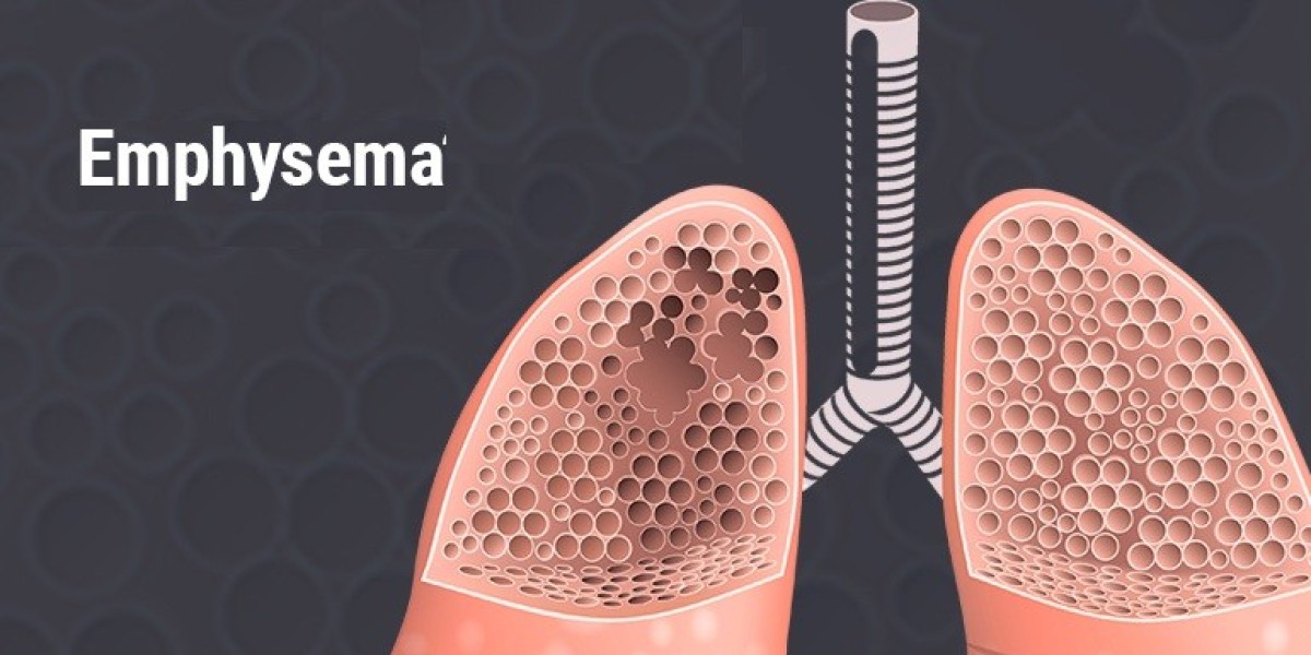 Emphysema Market Outlook including Industry Size, Share & Growth
