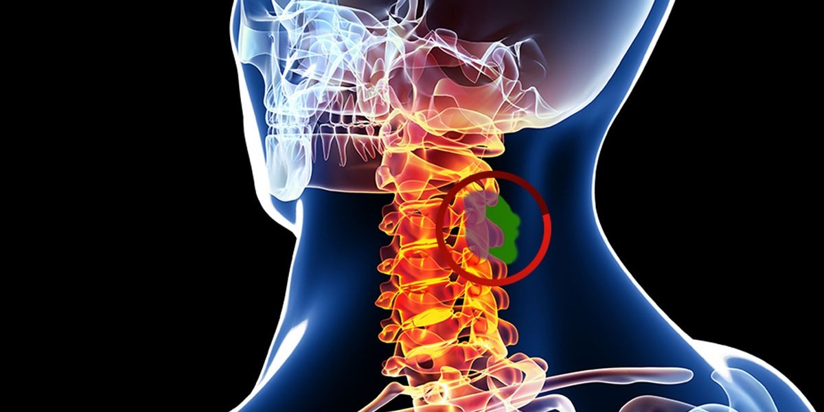 Metastases Spinal Tumor Market Outlook on Concerns Faced by the Industry