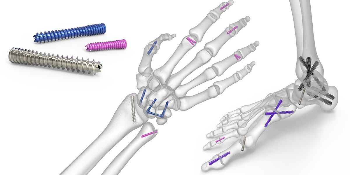 Fracture Fixation Products Market Outlook, Dynamics & Insights 2023-2032