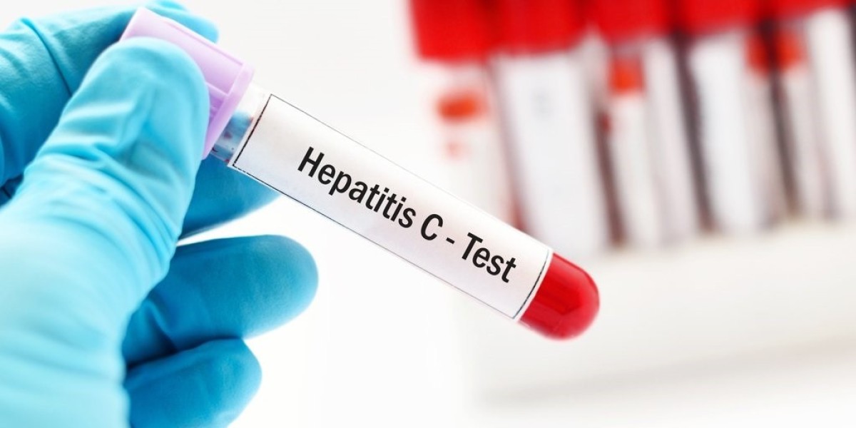 Huge Investments Made by Manufacturers is Expected to Boost Industry: The Hepatitis Test Solution Diagnosis Market Outlo