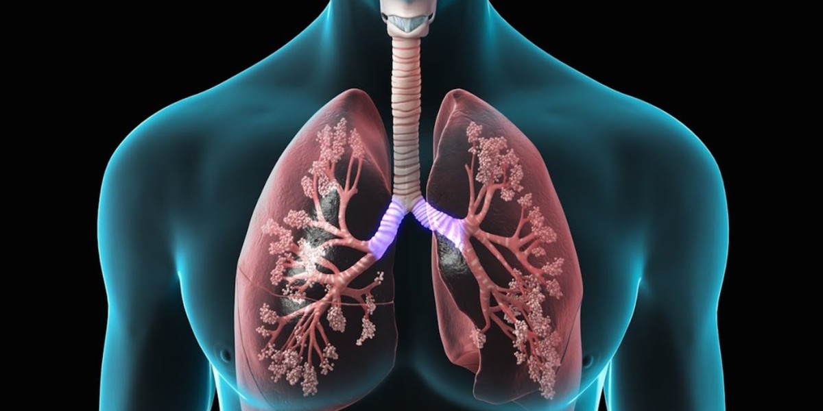 Obstructive Lung Disease Market Outlook on Industry CAGR Value over the Forecast Period