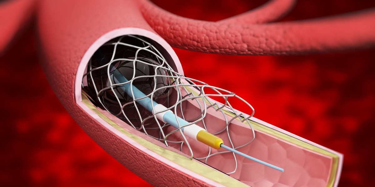 Vascular Stents Market Outlook on Concerns Faced by the Industry