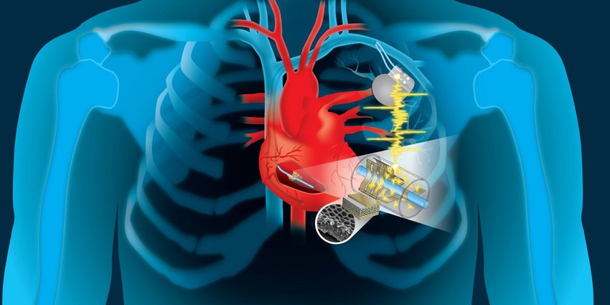 Cardiac Implants Market Outlook Report includes Global Industry Size & Forecasts