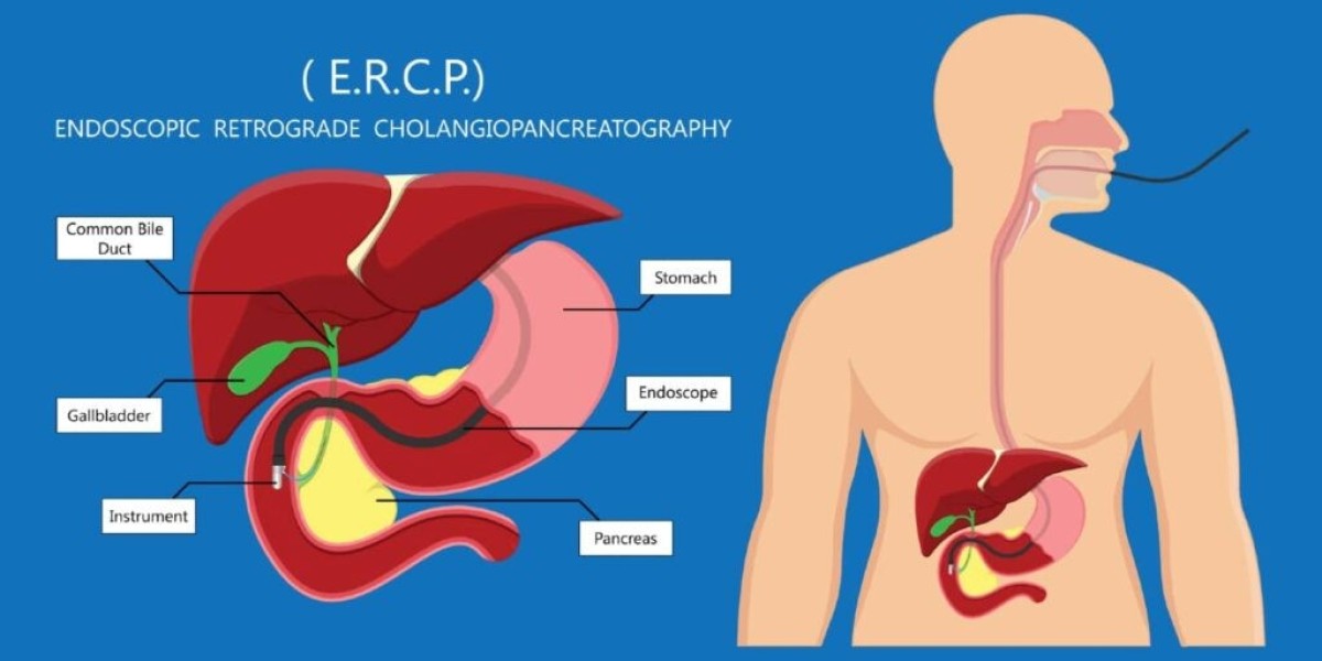 Endoscopic Retrograde Cholangiopancreatography Market Outlook on Industry CAGR Value over the Forecast Period