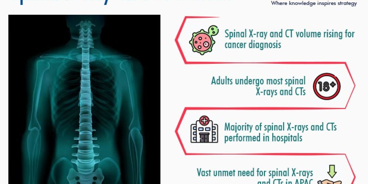 Spinal X-Ray and CT Market Insights, Leading Players and Forecast Report 2030