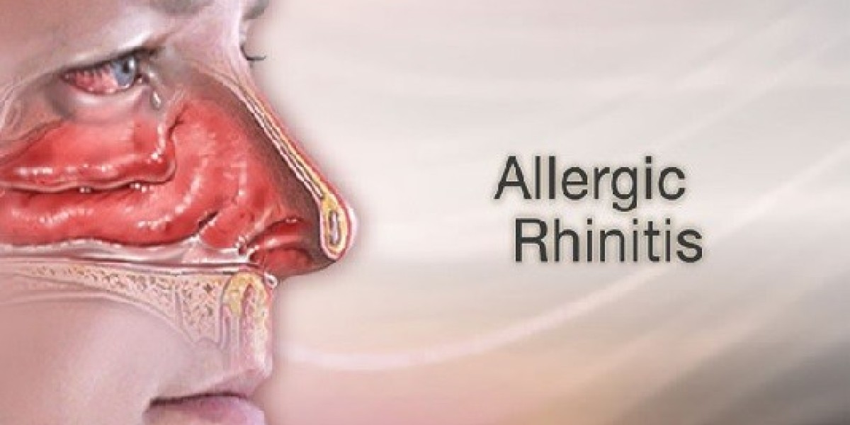 Allergic Rhinitis Market Trends, Emerging Technologies, Size and Market Segments by Forecast to 2030