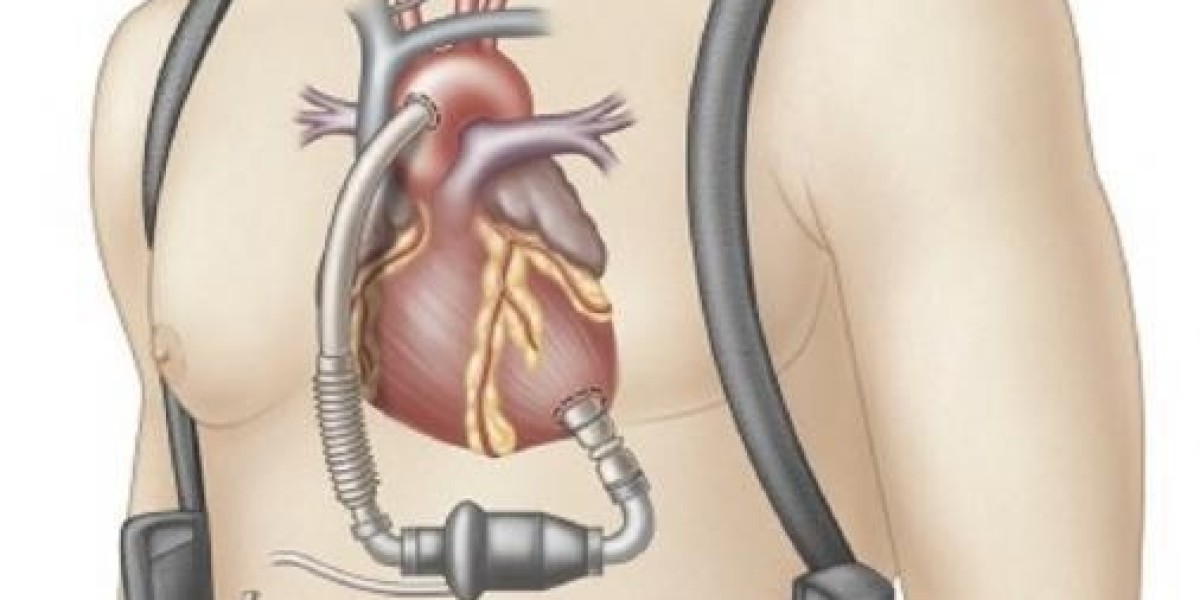 Ventricular Assist Devices Market Research, Development Status, Emerging Technologies, Revenue and Key Findings