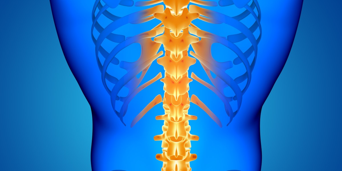 Spine Surgery: Things You Should Know
