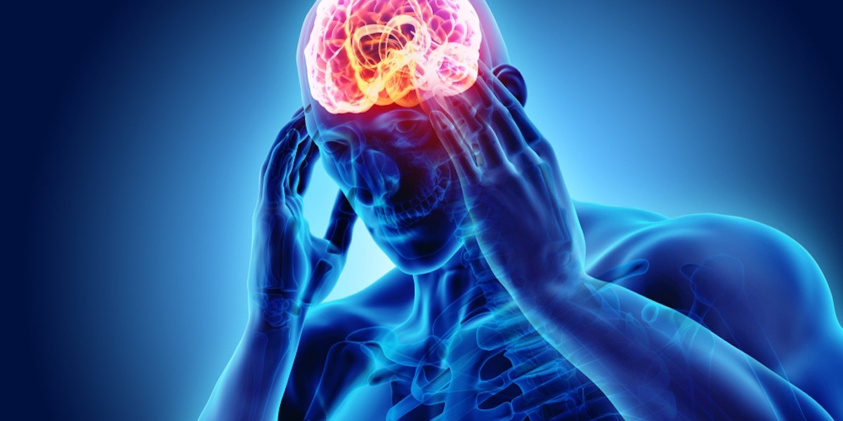 From Traditional Treatments to Gene Therapy: The Evolving Migraine Market
