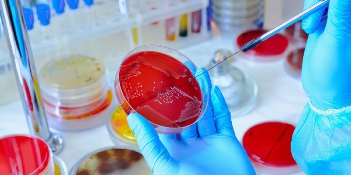 Safeguarding Our World: The Expanding Role of Microbiology Testing