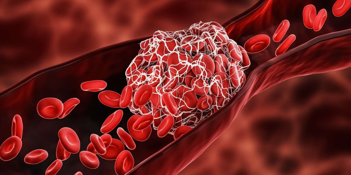 Blood Clot Prevention: How a Growing Market is Saving Lives